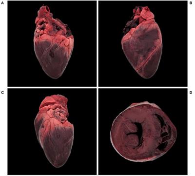 Cardiomyopathy Associated With Coronary Arteriosclerosis in Free-Ranging Eurasian Lynx (Lynx lynx carpathicus)